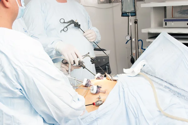 Gastric bypass-operation — Stockfoto