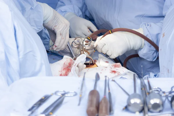 Procedimento cirúrgico — Fotografia de Stock