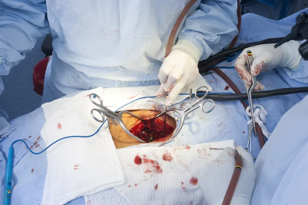 Surgical procedure — Stock Photo, Image