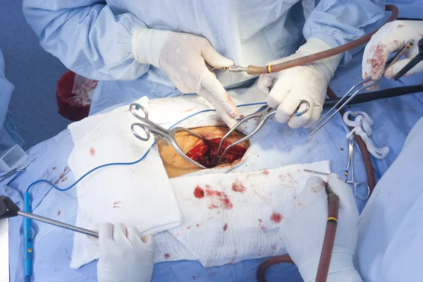 Surgical procedure — Stock Photo, Image