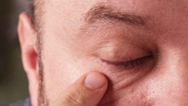 Männliche Augen Aus Nächster Nähe Sehprobleme Augencheck Konzept — Stockvideo