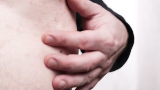 Ερεθισμός Χέρι Αγγίζει Δέρμα Εξανθήματα Δερματολογία Περιποίηση Δέρματος — Αρχείο Βίντεο