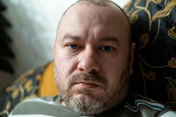 Ordinary Middle Aged Man Unshaven Face Man His Forties Unhealthy — стоковое фото