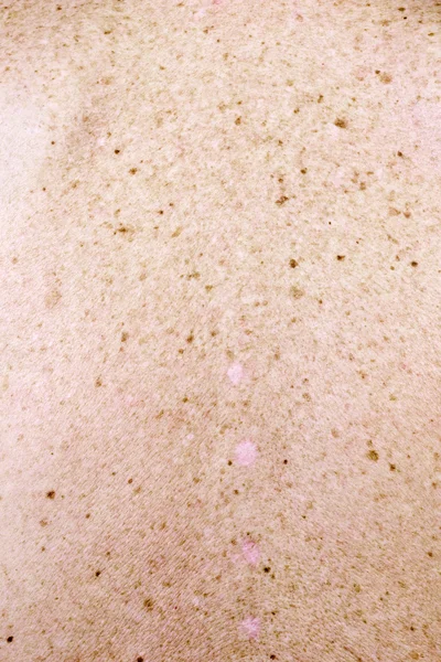 Superfície da pele humana — Fotografia de Stock
