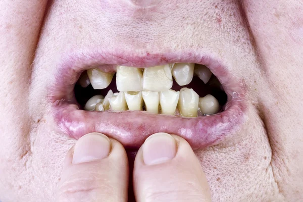 Желтые зубы студия выстрел — стоковое фото