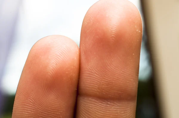 Zwei Finger — Stockfoto