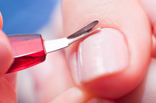 Girl cuts the skin at the nail — Stock Photo, Image