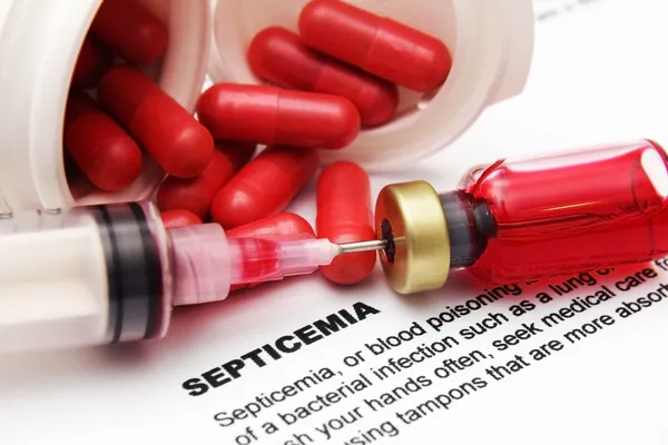 Septicemia — Stock Photo, Image
