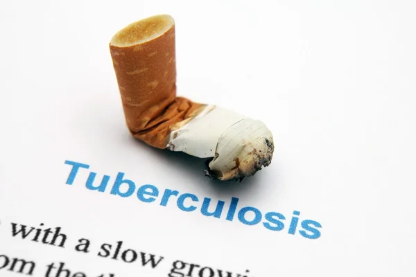 Tuberkulose — Stockfoto