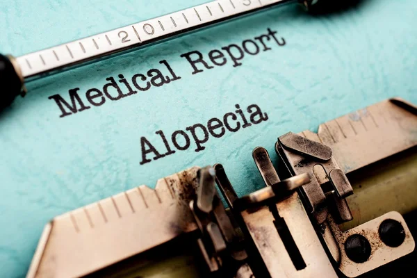 Alopécia — Fotografia de Stock