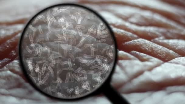 Búsqueda de bacterias en la piel humana — Vídeo de stock
