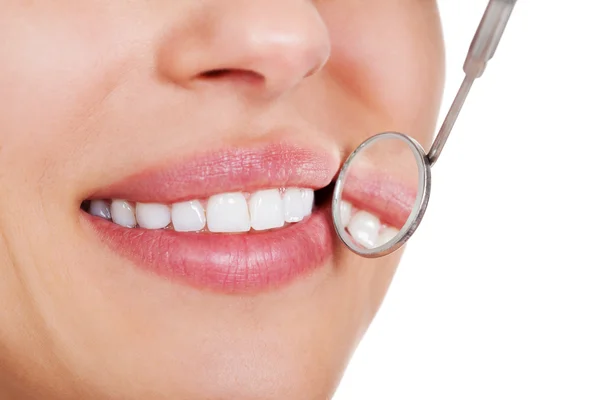 Mujer sonriente con dientes blancos —  Fotos de Stock