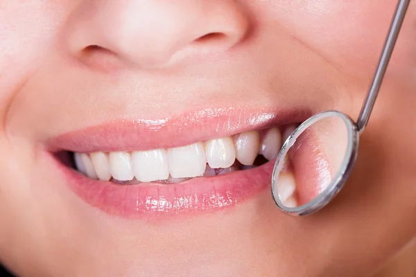 Usmívající se žena s dokonalé zuby — Stock fotografie