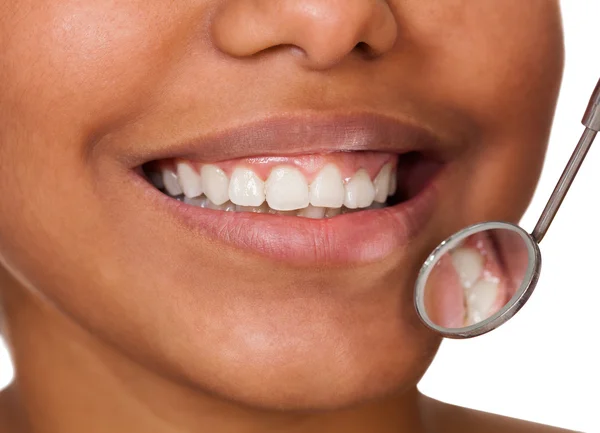 Healthy Woman Teeth — Stock Photo, Image