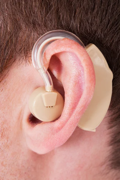 Hearing Aid On The Man 's Ear — стоковое фото