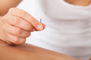 Akupunktur iğnesi uyarıcı el