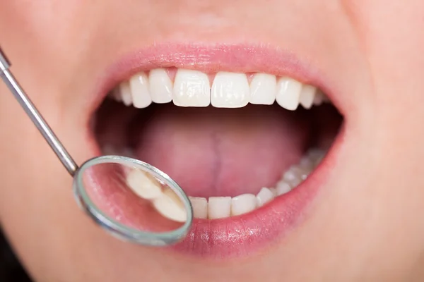 Diş incelemesi — Stok fotoğraf