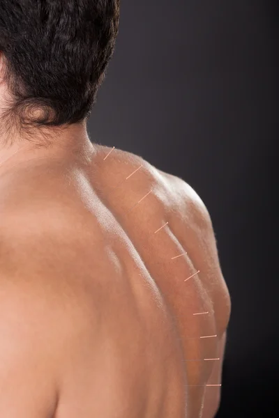 Людина з голковколювання голки на спині — стокове фото