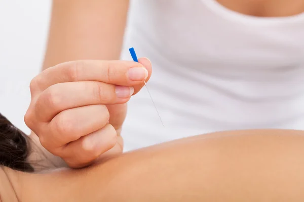 Masseuse Holding Needle — Stock Photo, Image