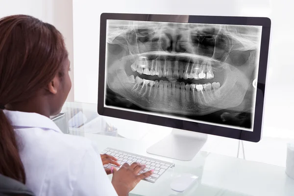 Dentista donna che esamina la mascella Raggi X sul computer in clinica — Foto Stock