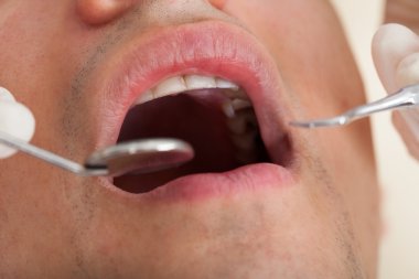 Klinik diş açmasıyla giden adam