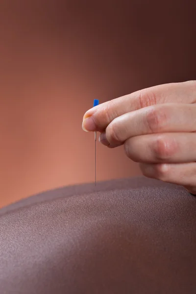 Mujer recibiendo tratamiento de acupuntura en el salón — Foto de Stock