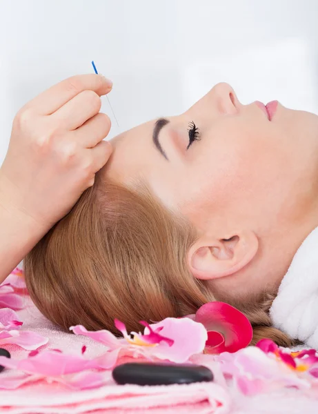 Mujer recibiendo tratamiento de acupuntura — Foto de Stock