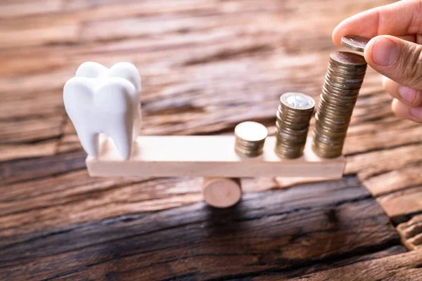 Kosten Für Zahnimplantate Zähne Versicherungsgeld — Stockfoto