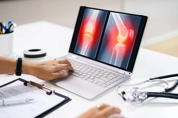 Médico Cirujano Mirando Rodilla Ray Bone Scan Usando Tecnología Software — Foto de Stock