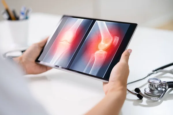 Chirurgen Arzt Bei Röntgenuntersuchung Des Knie Knochens Mit Software Technologie — Stockfoto