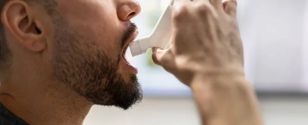 Homme Asthmatique Utilisant Inhalateur Asthme Pour Prévenir Les Crises — Photo