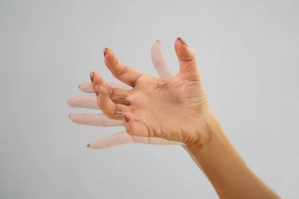 Persoon Hand Met Dystonie Degeneratieve Vergrijzing Beweging — Stockfoto