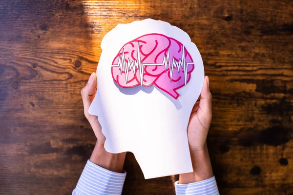 医療保険と脳てんかんの概念 — ストック写真