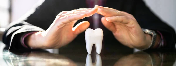 Dental Insurance. Protecting Teeth Enamel. Tooth Implant