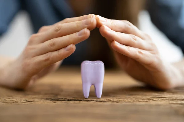 Dental Dente Seguro Substituir Serviço Esmalte — Fotografia de Stock