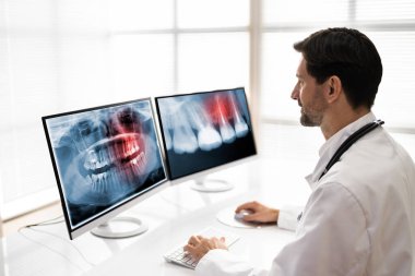 Doktor ya da Radyolog bir röntgene bakıyor.