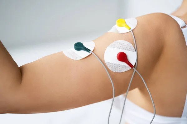 Elektrod Armstimulering Och Träning Smärtterapi Och Massage — Stockfoto