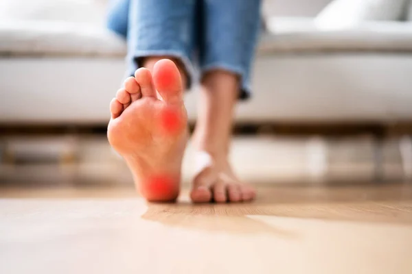 Fußfersenschmerzen Und Callus Care Nahaufnahme Weibliche Beingesundheit — Stockfoto