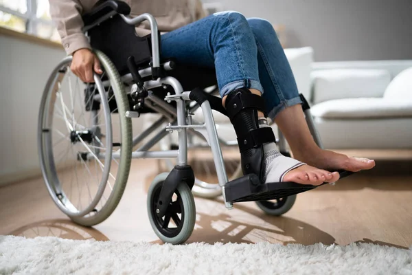 坐在轮椅上的年轻女人医疗伤害残疾 — 图库照片