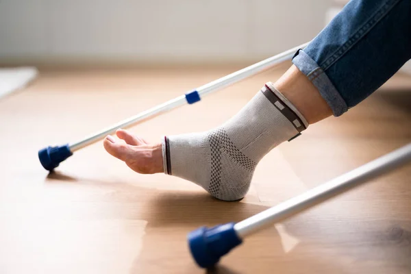 Бандаж Розтягування Медична Травма Ноги — стокове фото