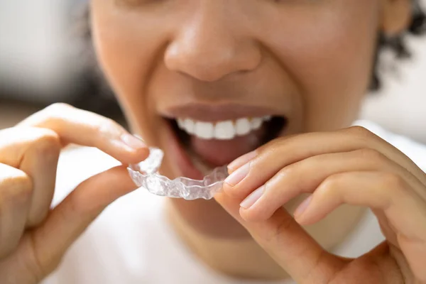 Clear Aligner Dental Night Guard Teeth — Stock Photo, Image