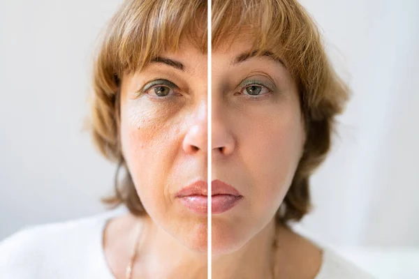 Foto Aging Förfaranden Kaukasisk Kvinna Ansikte — Stockfoto