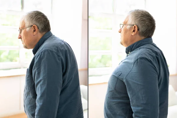 Man With Lordosis And Normal Curvature Against Gray Background