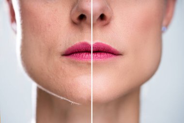 Anti-Aging yordamlar Kafkas kadın yüzündeki fotoğrafı
