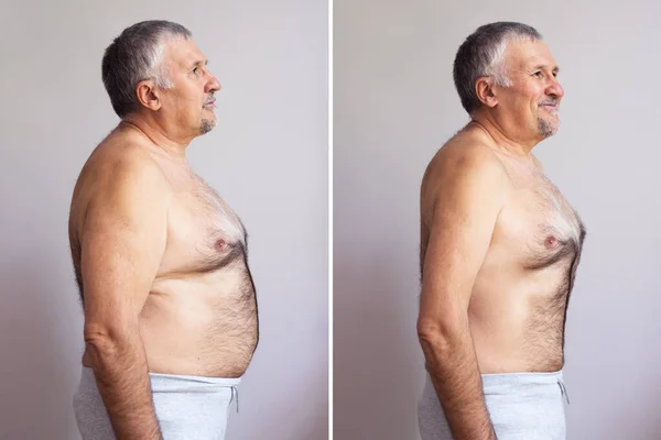 Boční Pohled Dospělého Muže Před Ztrátě Tuku Bílém Pozadí Tvar — Stock fotografie