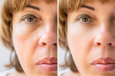 Anti-Aging yordamlar Kafkas kadın yüzündeki fotoğrafı