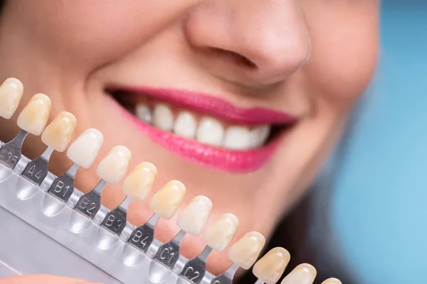 インプラント歯の陰に一致する幸せな女のクローズ アップ — ストック写真