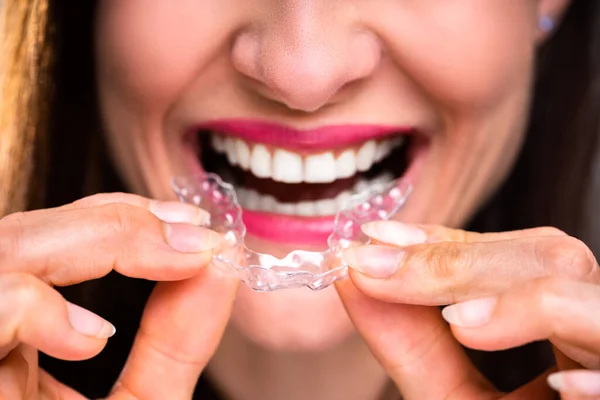 Zbliżenie Kobiety Dostosowującej Przezroczyste Wyrównujące Swoich Białych Zębach — Zdjęcie stockowe