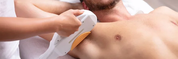 Närbild Leende Ung Man Med Underarm Laser Hårborttagning Behandling Spa — Stockfoto