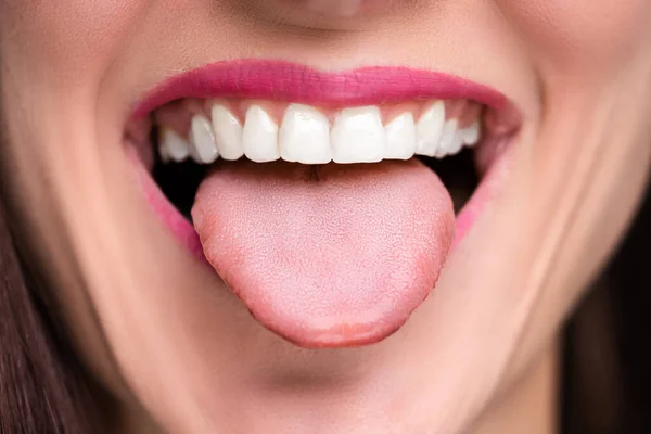 Close Van Een Vrouw Gezicht Tonen Haar Schone Tong — Stockfoto